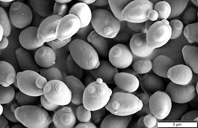 Saccharomyces_cerevisiae_SEM